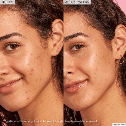 Glow Recipe – Serum Facial Strawberry Smooth BHA + AHA Salicylic Serum