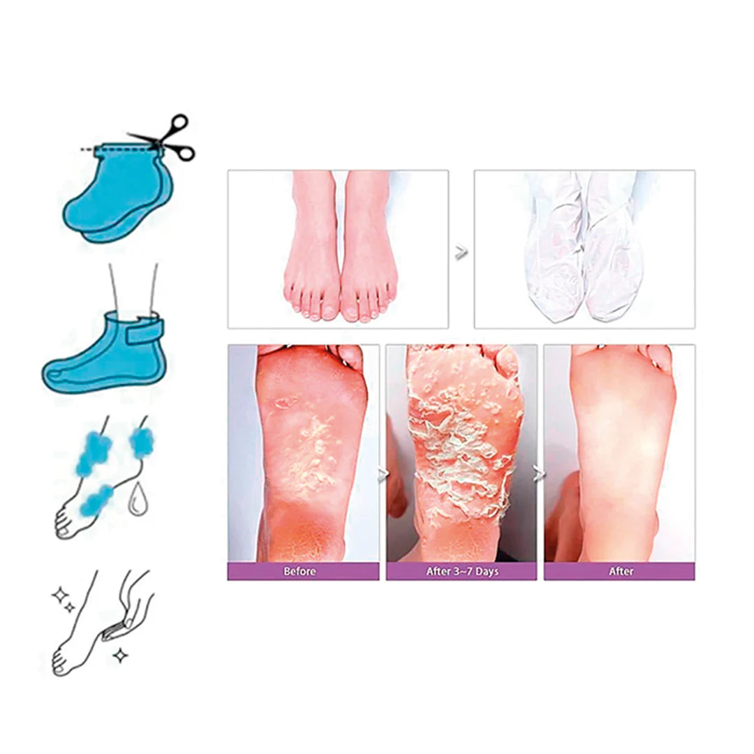 Tony Moly – Mascarilla Exfoliante Changing Magic Foot Peeling Shoes